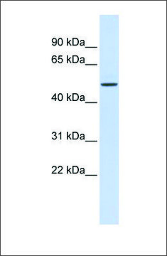 Anti-ELK4 antibody produced in rabbit affinity isolated antibody