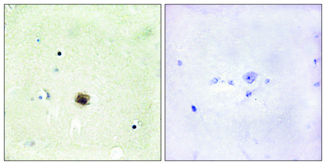 Anti-CRP1 antibody produced in rabbit affinity isolated antibody