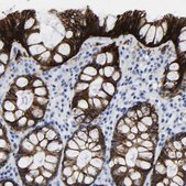 Anti-GPA33 antibody produced in rabbit Prestige Antibodies&#174; Powered by Atlas Antibodies, affinity isolated antibody, buffered aqueous glycerol solution