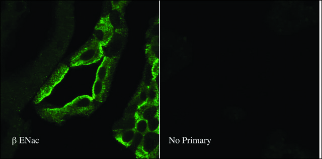 Anti-SCNN1B antibody produced in rabbit 1&#160;mg/mL, affinity isolated antibody