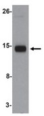 Anti-IFITM1 Antibody from rabbit, purified by affinity chromatography