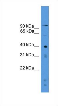 Anti-PRSS23 antibody produced in rabbit affinity isolated antibody