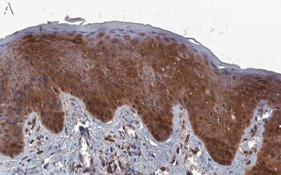 Anti-Cytokeratin-17 Antibody, clone 2K20 ZooMAb&#174; Rabbit Monoclonal recombinant, expressed in HEK 293 cells