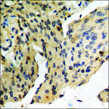 Anti-phospho-PAK3 (pSer154) antibody produced in rabbit affinity isolated antibody