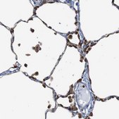 Anti-PTPN1 antibody produced in rabbit Prestige Antibodies&#174; Powered by Atlas Antibodies, affinity isolated antibody, buffered aqueous glycerol solution