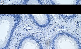 Anti-ECM1 Antibody, clone 1C6 ZooMAb&#174; Rabbit Monoclonal recombinant, expressed in HEK 293 cells