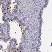 Anti-GLA antibody produced in rabbit Ab2, Prestige Antibodies&#174; Powered by Atlas Antibodies, affinity isolated antibody, buffered aqueous glycerol solution
