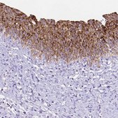 Anti-DHRS2 antibody produced in rabbit Prestige Antibodies&#174; Powered by Atlas Antibodies, affinity isolated antibody, buffered aqueous glycerol solution