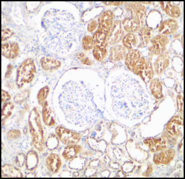 Anti-XIAP antibody produced in rabbit affinity isolated antibody, buffered aqueous solution