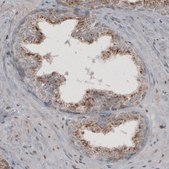 Monoclonal Anti-ACAA1 antibody produced in mouse Prestige Antibodies&#174; Powered by Atlas Antibodies, clone CL2662, purified immunoglobulin, buffered aqueous glycerol solution