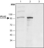 Anti-Phospholipase A2 (iPLA2) (C-terminal region) antibody produced in rabbit ~1.5&#160;mg/mL, affinity isolated antibody