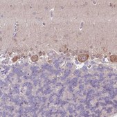 Anti-SLC26A6 antibody produced in rabbit Prestige Antibodies&#174; Powered by Atlas Antibodies, affinity isolated antibody, buffered aqueous glycerol solution