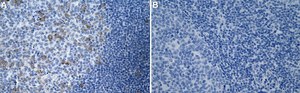 Anti-RRM1 Antibody, clone 1E20 ZooMAb&#174; Rabbit Monoclonal recombinant, expressed in HEK 293 cells