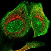 Anti-RSBN1L antibody produced in rabbit Prestige Antibodies&#174; Powered by Atlas Antibodies, affinity isolated antibody, buffered aqueous glycerol solution, Ab2