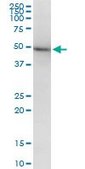 Monoclonal Anti-TUBB2A antibody produced in mouse clone 2B2, purified immunoglobulin, buffered aqueous solution