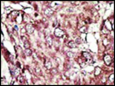 Anti-PRMT7 (N-term) antibody produced in rabbit saturated ammonium sulfate (SAS) precipitated, buffered aqueous solution