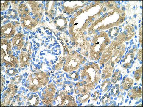 Anti-ADAMTS4 affinity isolated antibody