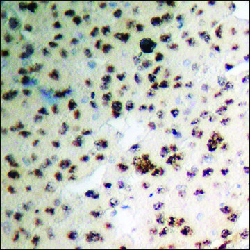 Anti-phospho-ACC1 (pSer80) antibody produced in rabbit affinity isolated antibody