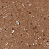 Anti-BRAF antibody produced in rabbit Prestige Antibodies&#174; Powered by Atlas Antibodies, affinity isolated antibody, buffered aqueous glycerol solution