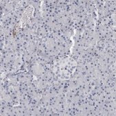 Anti-TNR antibody produced in rabbit Prestige Antibodies&#174; Powered by Atlas Antibodies, affinity isolated antibody, buffered aqueous glycerol solution, Ab1