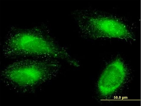 Anti-FN1 antibody produced in mouse purified immunoglobulin, buffered aqueous solution