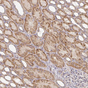 Anti-IRAK2 antibody produced in rabbit Prestige Antibodies&#174; Powered by Atlas Antibodies, affinity isolated antibody, buffered aqueous glycerol solution