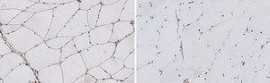 Anti-&#945;-Dystroglycan Antibody, clone VIA4-1 ZooMAb&#174; Mouse Monoclonal recombinant, expressed in HEK 293 cells