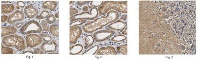 Anti-L1CAM Antibody from rabbit, purified by affinity chromatography