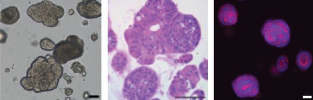 3dGRO&#174; Human CRC Organoids (ISO34)