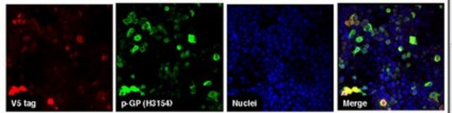 Anti-C9ORF72/C9RANT (Poly-GP sense/antisense) serum, from rabbit