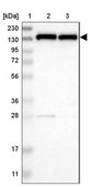 Anti-UBE4B antibody produced in rabbit Prestige Antibodies&#174; Powered by Atlas Antibodies, affinity isolated antibody, buffered aqueous glycerol solution