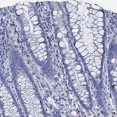 Anti-APOD antibody produced in rabbit Prestige Antibodies&#174; Powered by Atlas Antibodies, affinity isolated antibody