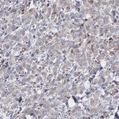 Anti-ERBB2 antibody produced in rabbit Ab1, Prestige Antibodies&#174; Powered by Atlas Antibodies, affinity isolated antibody, buffered aqueous glycerol solution