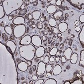 Anti-CTSB antibody produced in rabbit Prestige Antibodies&#174; Powered by Atlas Antibodies, affinity isolated antibody, buffered aqueous glycerol solution