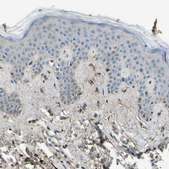 Anti-COL3A1 antibody produced in rabbit Prestige Antibodies&#174; Powered by Atlas Antibodies, affinity isolated antibody, buffered aqueous glycerol solution