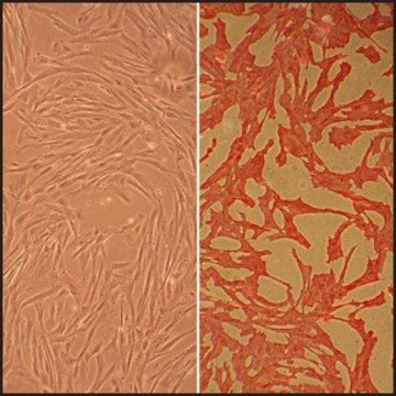 Canine Aortic Smooth Muscle Cells: CnAOSMC (Cryovial)