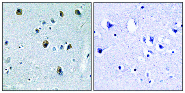 Anti-Collagen XX &#945;1 antibody produced in rabbit affinity isolated antibody