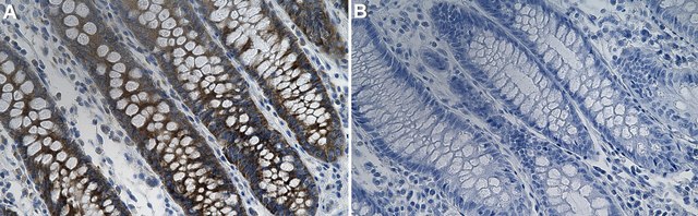 Anti-GSPT1 Antibody, clone 1F21 ZooMAb&#174; Rabbit Monoclonal recombinant, expressed in HEK 293 cells