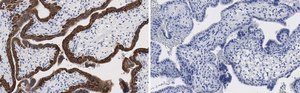 Anti-Keratin 7 Antibody, clone 3O4 ZooMAb&#174; Rabbit Monoclonal recombinant, expressed in HEK 293 cells