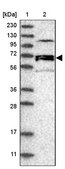 Anti-NET1 antibody produced in rabbit Prestige Antibodies&#174; Powered by Atlas Antibodies, affinity isolated antibody, buffered aqueous glycerol solution
