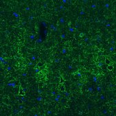 Monoclonal Anti-GAD1 antibody produced in mouse Prestige Antibodies&#174; Powered by Atlas Antibodies, clone CL2919, purified immunoglobulin, buffered aqueous glycerol solution