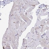 Anti-CD163 antibody produced in rabbit Prestige Antibodies&#174; Powered by Atlas Antibodies, affinity isolated antibody, buffered aqueous glycerol solution