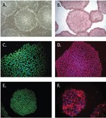 PluriSTEM&#174; Human ES/iPS Cell Medium Defined small molecule based serum-free medium that enables feeder-free culture of human ES/iPS cells and allows for media exchanges every other day without compromising the morphology or long term functionality of human pluripotent stem cells.