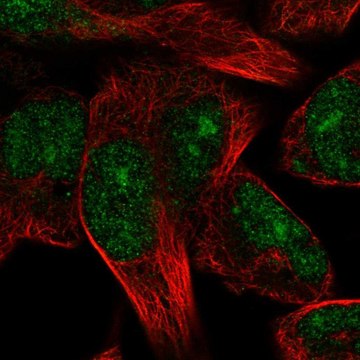 Anti-TRIM72 antibody produced in rabbit Prestige Antibodies&#174; Powered by Atlas Antibodies, affinity isolated antibody, buffered aqueous glycerol solution