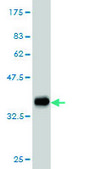 Monoclonal Anti-FGR antibody produced in mouse clone 3G10, purified immunoglobulin, buffered aqueous solution