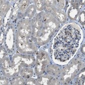 Anti-GYPA antibody produced in rabbit Prestige Antibodies&#174; Powered by Atlas Antibodies, affinity isolated antibody, buffered aqueous glycerol solution