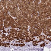 Anti-CYP21A2 antibody produced in rabbit Prestige Antibodies&#174; Powered by Atlas Antibodies, affinity isolated antibody, buffered aqueous glycerol solution