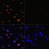 Anti-Acetyl-Histone H4-K16 antibody produced in rabbit