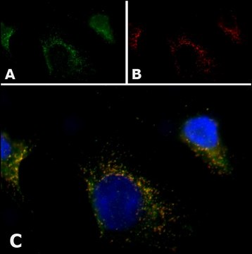 Anti-PMP70 antibody, Mouse monoclonal clone 70-18, purified from hybridoma cell culture