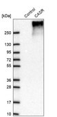 Anti-CASR antibody produced in rabbit Prestige Antibodies&#174; Powered by Atlas Antibodies, affinity isolated antibody, buffered aqueous glycerol solution